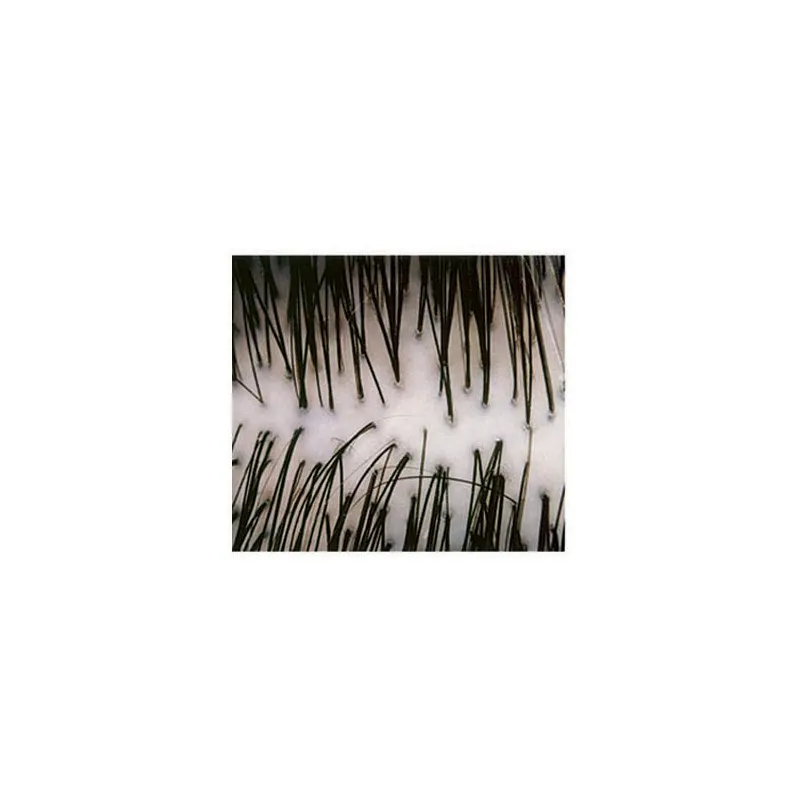 Vichy Dercos Champu Anticaspa Seco 200ml